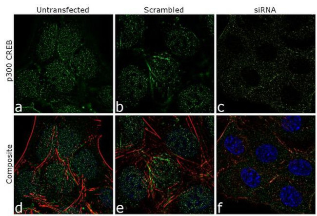 CBP Antibody in Immunocytochemistry (ICC/IF)