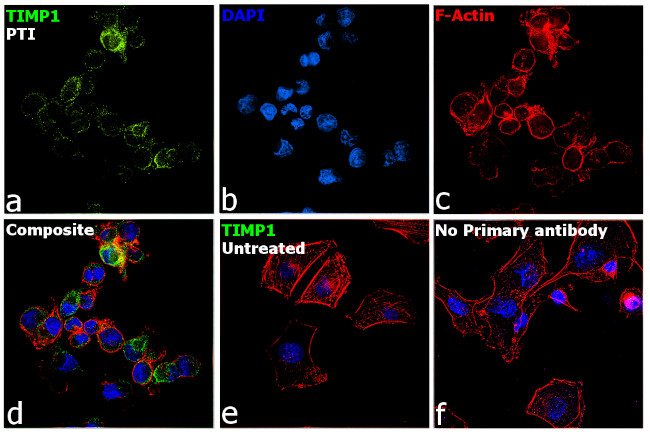 TIMP1 Antibody