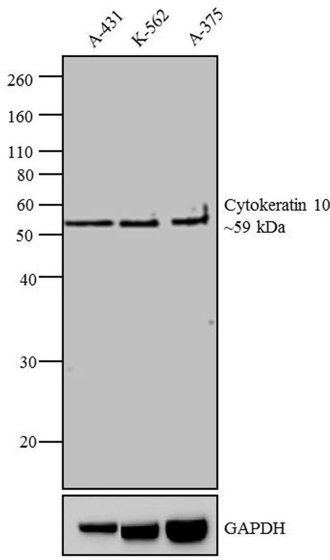 Cytokeratin 10 Antibody in Western Blot (WB)