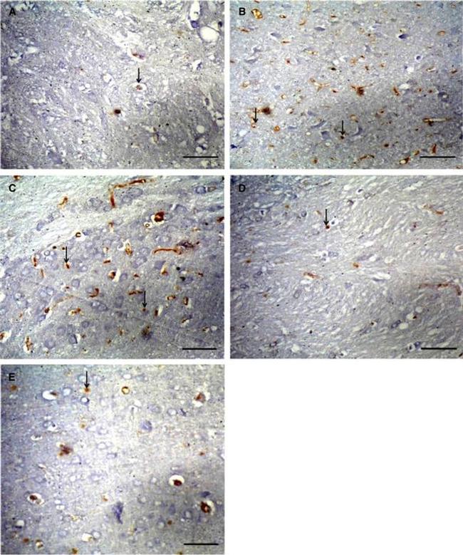 Bax Antibody in Immunohistochemistry (Paraffin) (IHC (P))