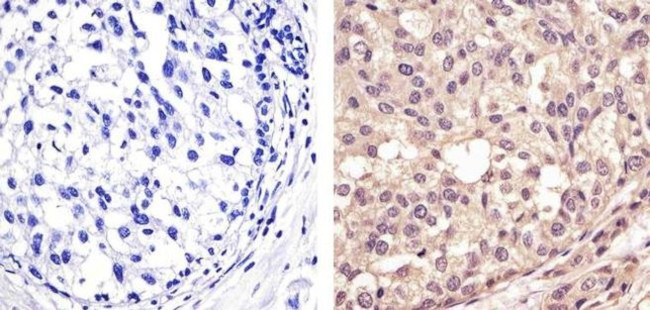 p53 Antibody in Immunohistochemistry (Paraffin) (IHC (P))