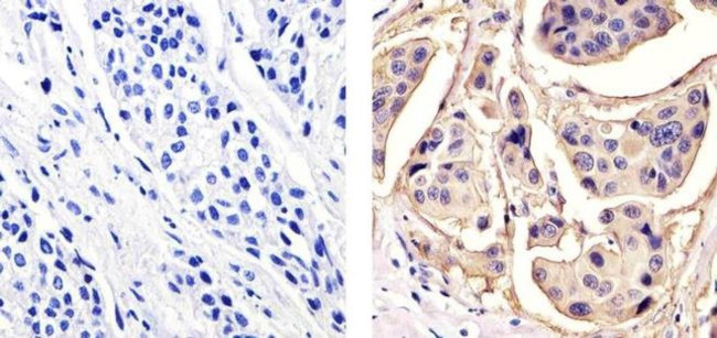 MUC1 Antibody in Immunohistochemistry (Paraffin) (IHC (P))