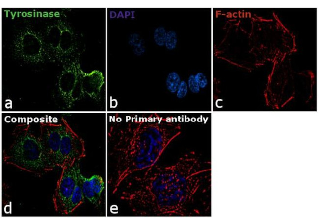 Tyrosinase Antibody in Immunocytochemistry (ICC/IF)