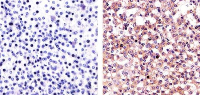 c-Abl Antibody in Immunohistochemistry (Paraffin) (IHC (P))