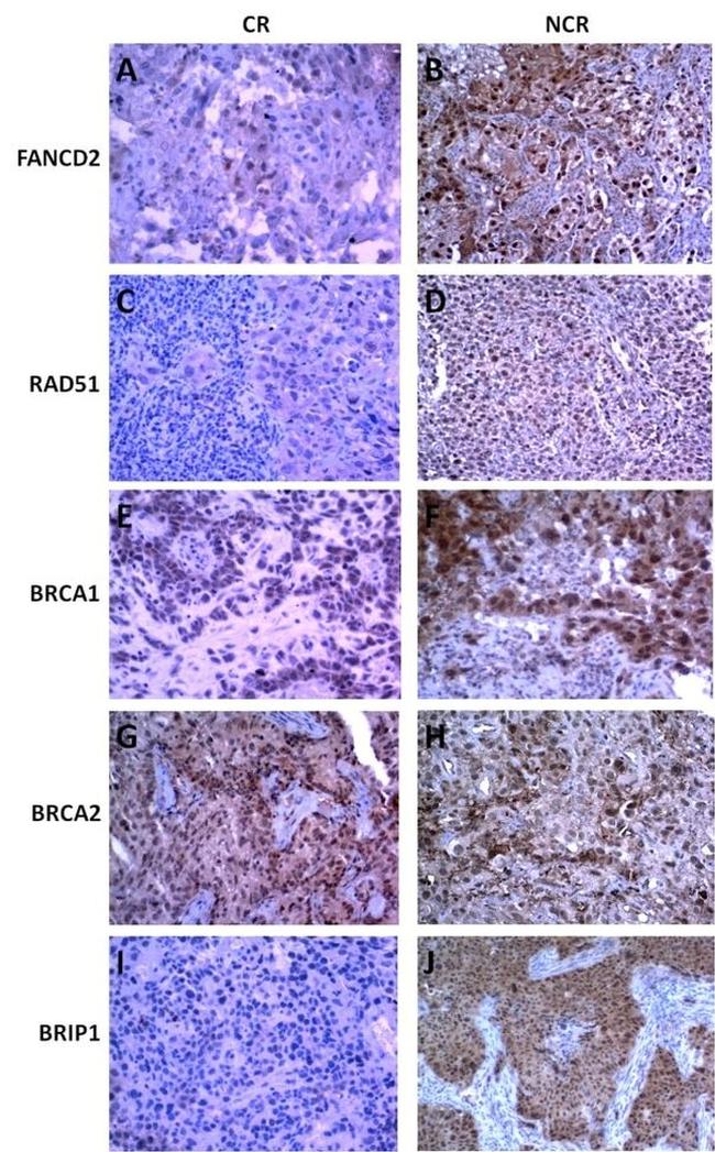 FANCD2 Antibody in Immunohistochemistry (IHC)