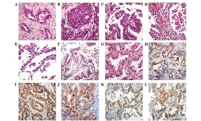 VEGF Receptor 2 Antibody in Immunohistochemistry (Paraffin) (IHC (P))