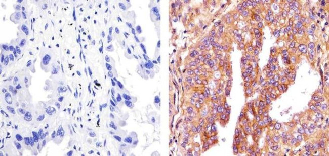 E-cadherin Antibody in Immunohistochemistry (Paraffin) (IHC (P))