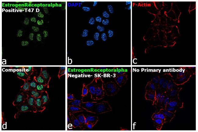 Estrogen Receptor alpha Antibody in Immunocytochemistry (ICC/IF)