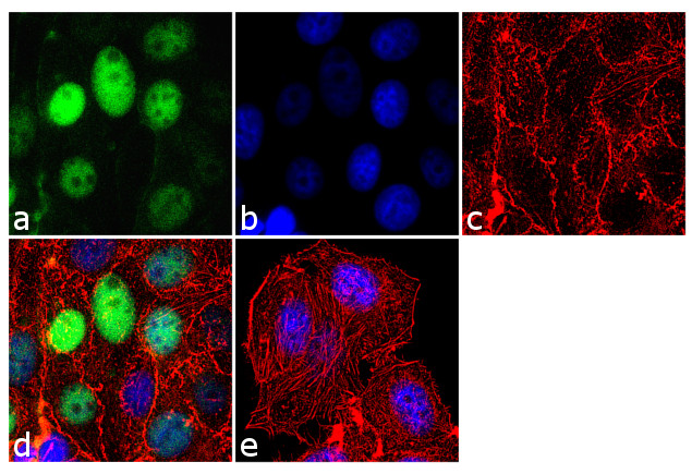 Progesterone Receptor Antibody in Immunocytochemistry (ICC/IF)