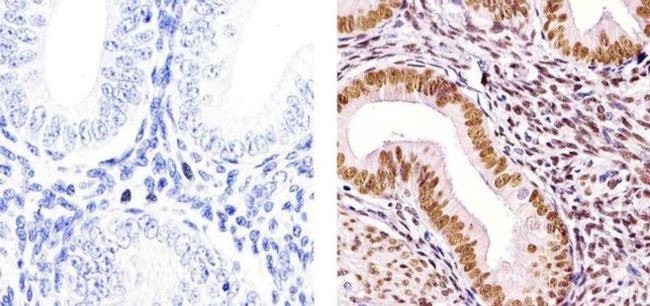 Progesterone Receptor Antibody in Immunohistochemistry (Paraffin) (IHC (P))