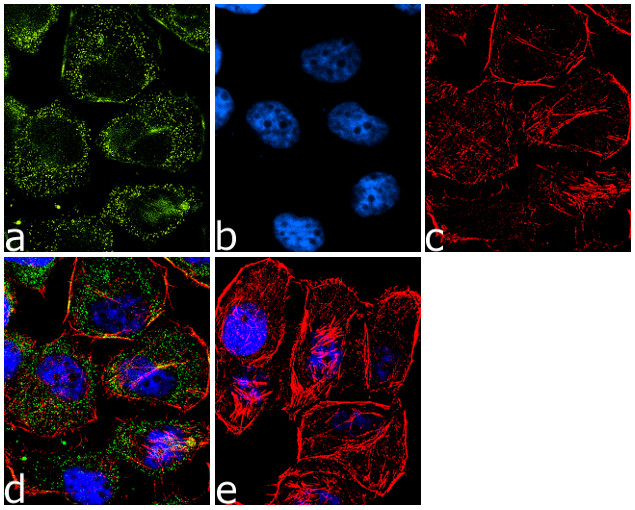 ErbB2 (HER-2) Antibody in Immunocytochemistry (ICC/IF)