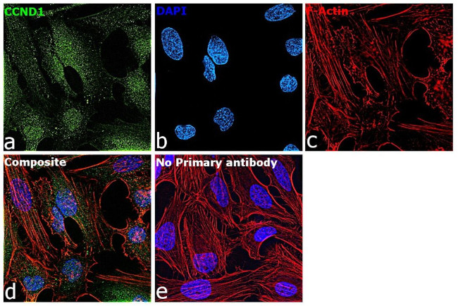 Cyclin D1 Antibody in Immunocytochemistry (ICC/IF)