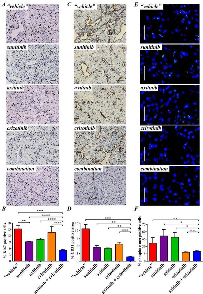 Phospho-c-Met (Tyr1230, Tyr1234, Tyr1235) Antibody in Immunohistochemistry (IHC)