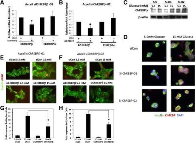 ChREBP Antibody in Immunocytochemistry (ICC/IF)