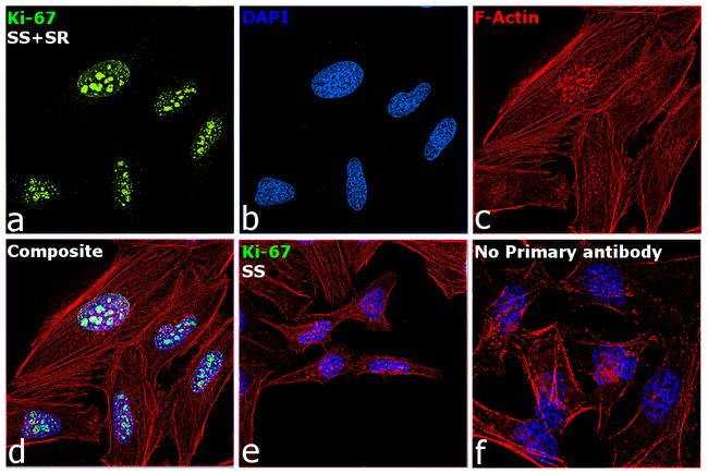 Ki-67 Antibody