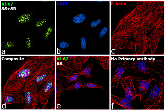 Ki-67 Antibody in Immunocytochemistry (ICC/IF)