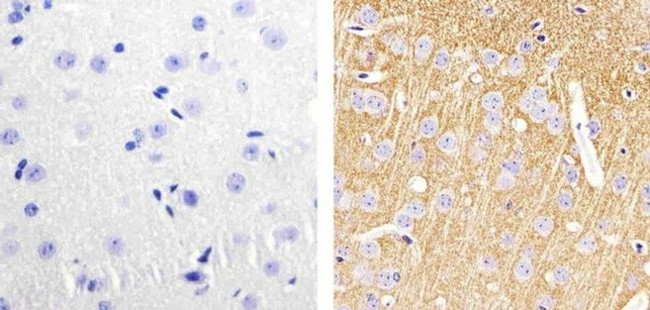 Synaptophysin Antibody in Immunohistochemistry (Paraffin) (IHC (P))