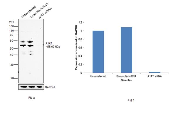 alpha-1 Antitrypsin Antibody in Western Blot (WB)