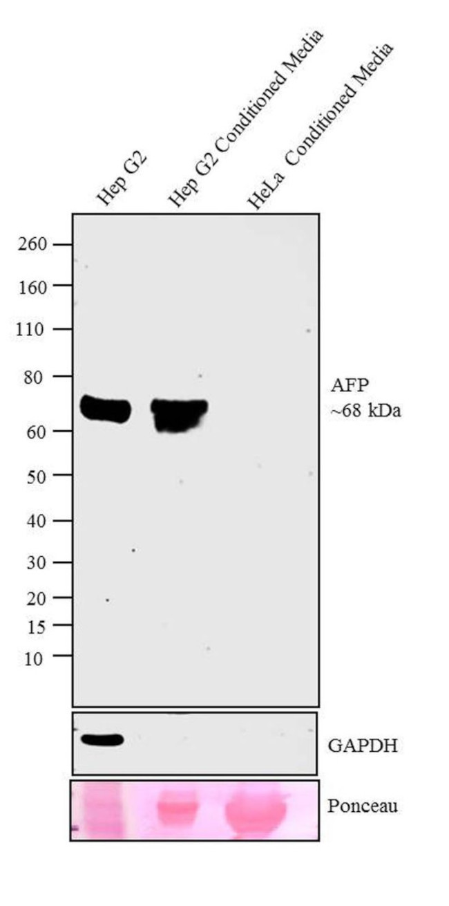 AFP Antibody