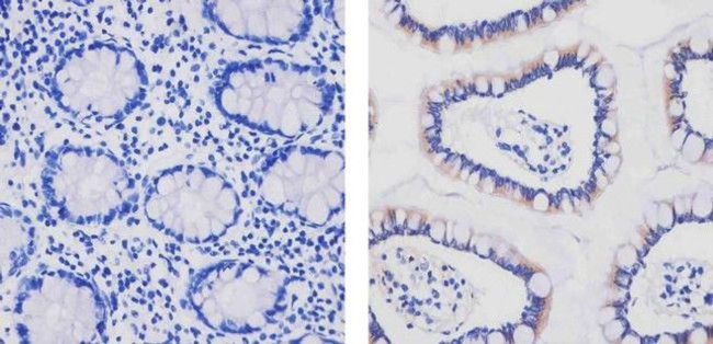 Apolipoprotein B Antibody in Immunohistochemistry (Paraffin) (IHC (P))