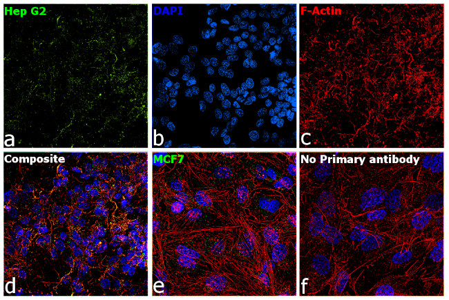 Ferritin Antibody in Immunocytochemistry (ICC/IF)