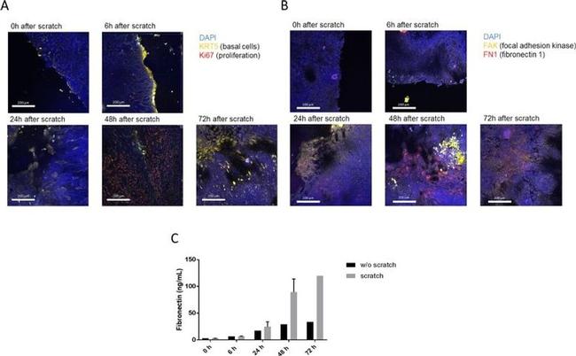 Fibronectin Antibody in Immunohistochemistry (IHC)