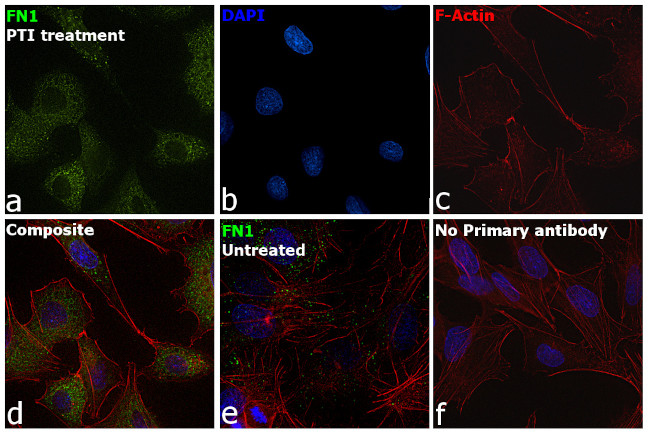 Fibronectin Antibody in Immunocytochemistry (ICC/IF)