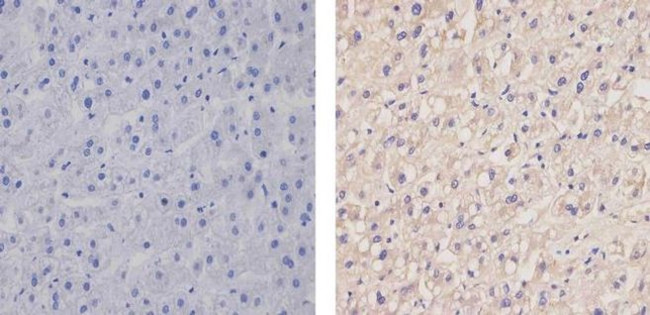 Apolipoprotein B Antibody in Immunohistochemistry (Paraffin) (IHC (P))