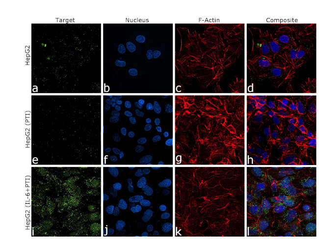 CRP Antibody in Immunocytochemistry (ICC/IF)