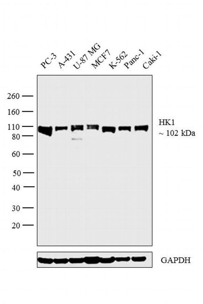 HK1 Antibody in Western Blot (WB)