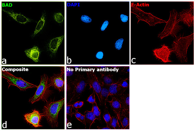 BAD Antibody in Immunocytochemistry (ICC/IF)