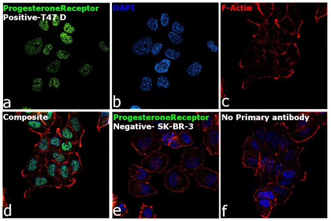 Progesterone Receptor Antibody