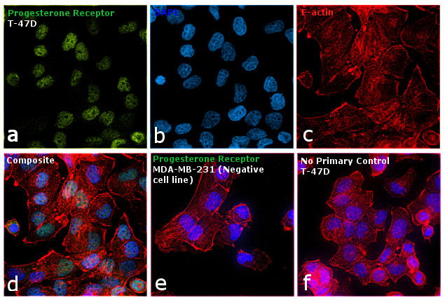 Progesterone Receptor Antibody