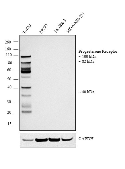 Progesterone Receptor Antibody