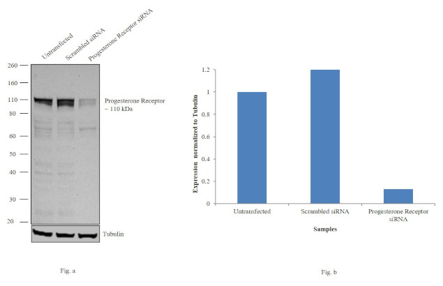 Progesterone Receptor Antibody