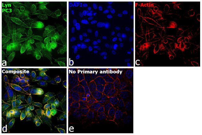 Lyn Antibody in Immunocytochemistry (ICC/IF)