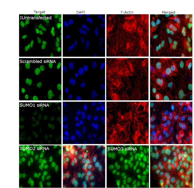 SUMO1 Antibody in Immunocytochemistry (ICC/IF)