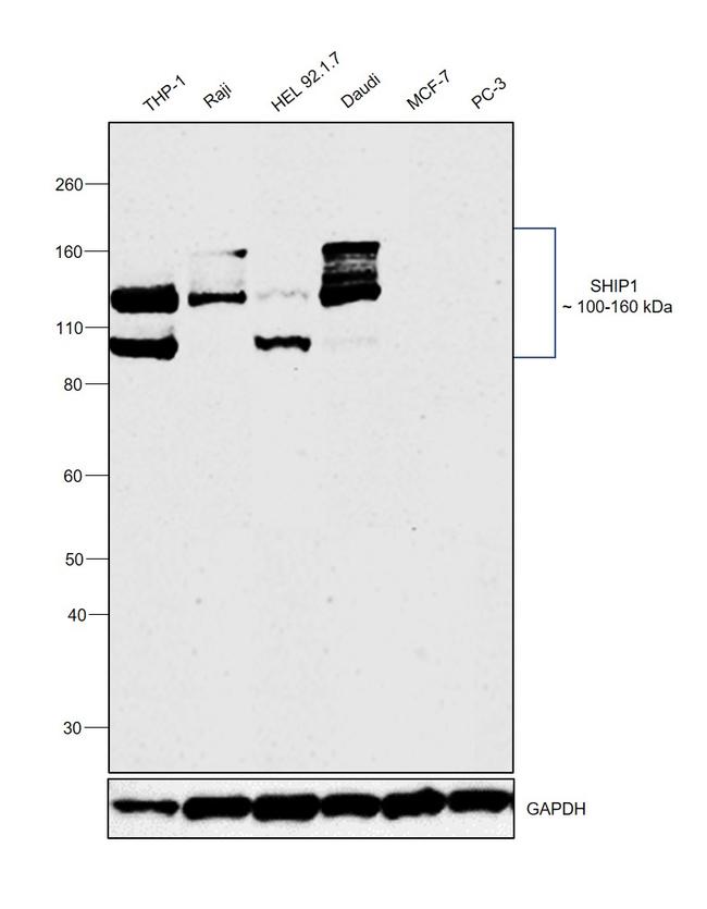 SHIP1 Antibody in Western Blot (WB)