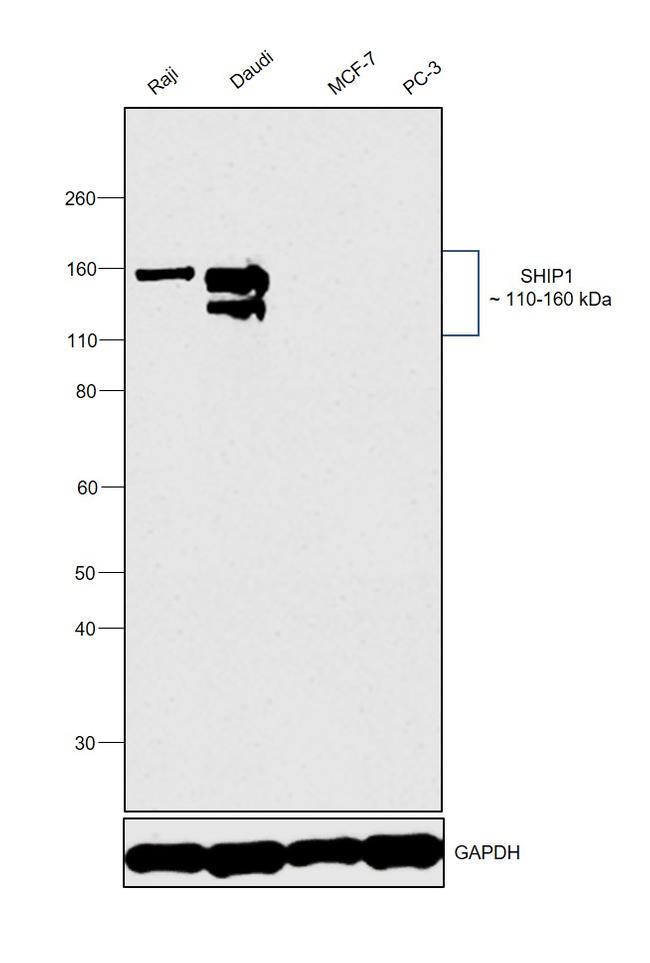 SHIP1 Antibody in Western Blot (WB)