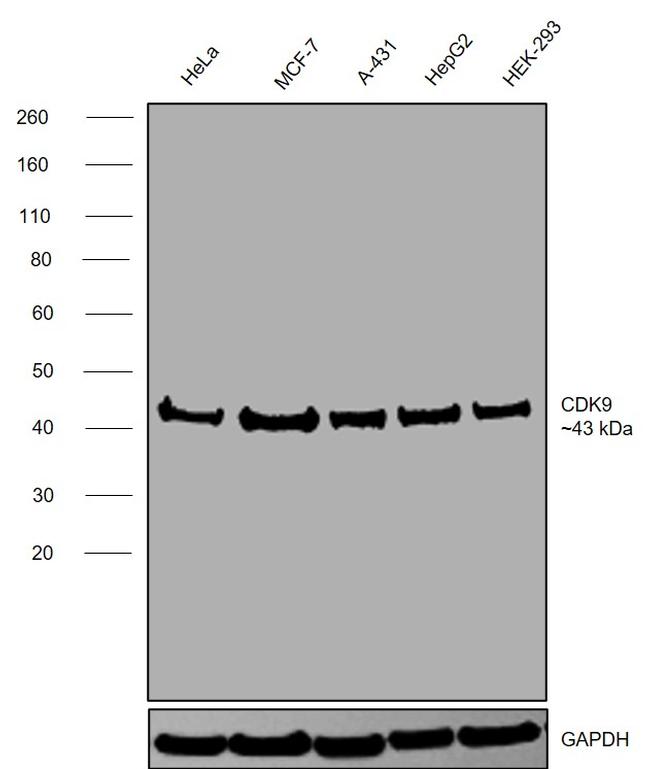 CDK9 Antibody in Western Blot (WB)