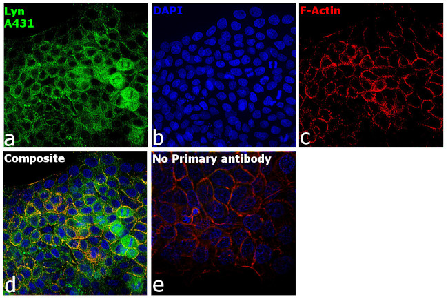 Lyn Antibody in Immunocytochemistry (ICC/IF)