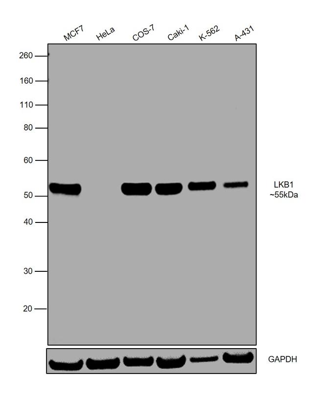 LKB1 Antibody in Western Blot (WB)