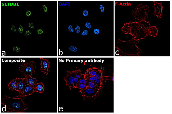 SETDB1 Antibody in Immunocytochemistry (ICC/IF)