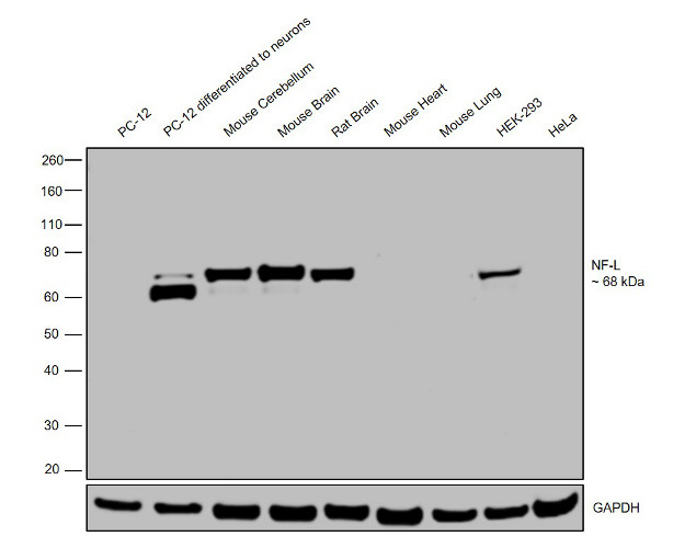 NEFL Antibody