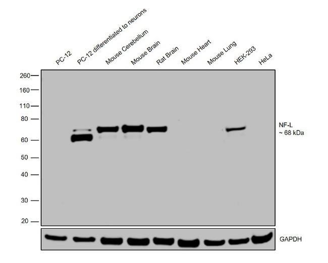 NEFL Antibody in Western Blot (WB)