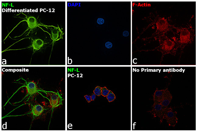 NEFL Antibody in Immunocytochemistry (ICC/IF)