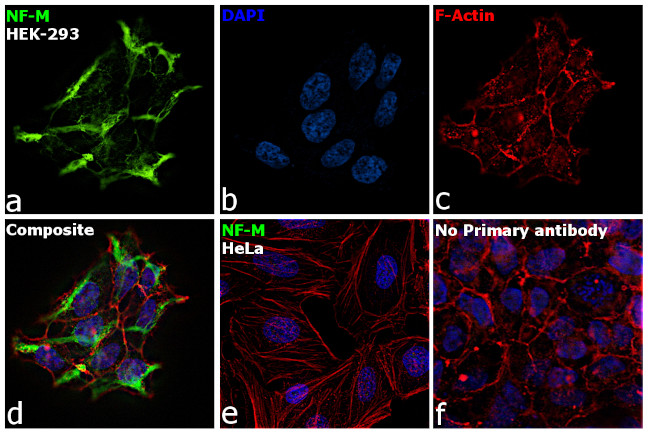 NEFL Antibody in Immunocytochemistry (ICC/IF)