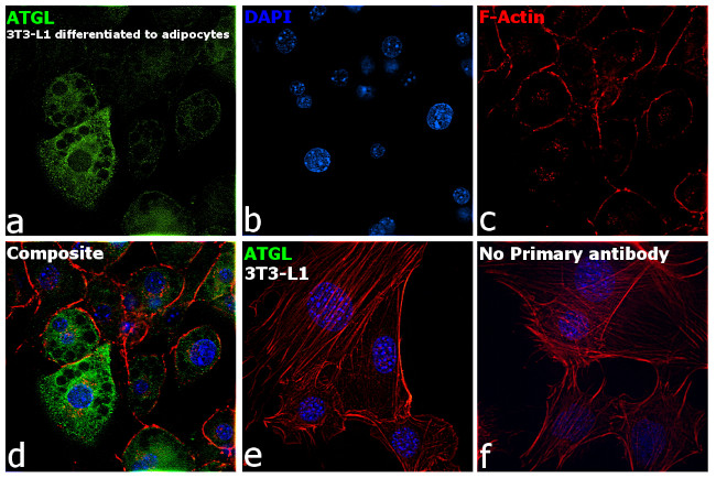 ATGL Antibody