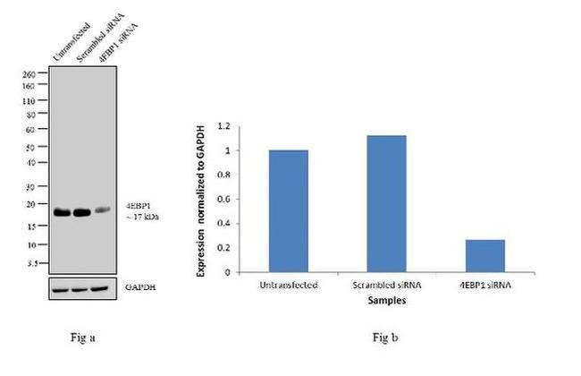 4EBP1 Antibody in Western Blot (WB)