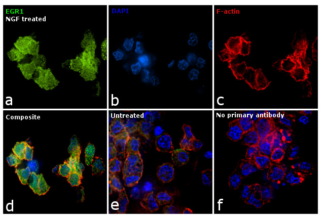 EGR1 Antibody in Immunocytochemistry (ICC/IF)